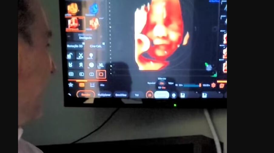 Foto: Redes sociais/ Reprodução