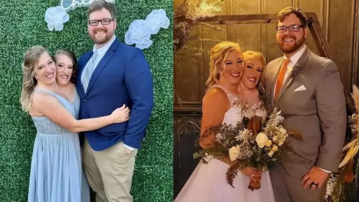 Gêmeas siamesas se casa com veterano do Exército