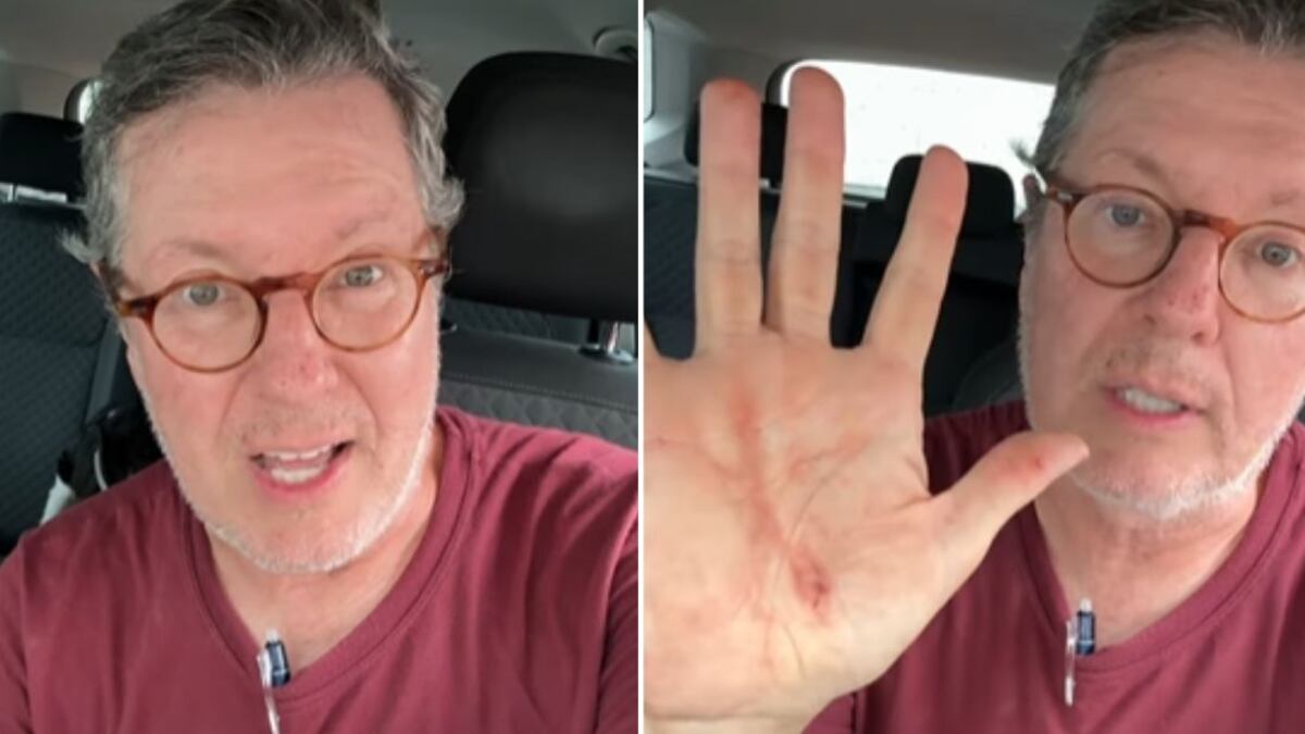 Bandido queria levar seu celular, mas não conseguiu.