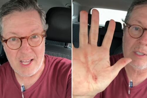 VÍDEO: Márcio Gomes, âncora da CNN, fica ferido em tentativa de assalto na Zona Norte de SP: “Chateado”