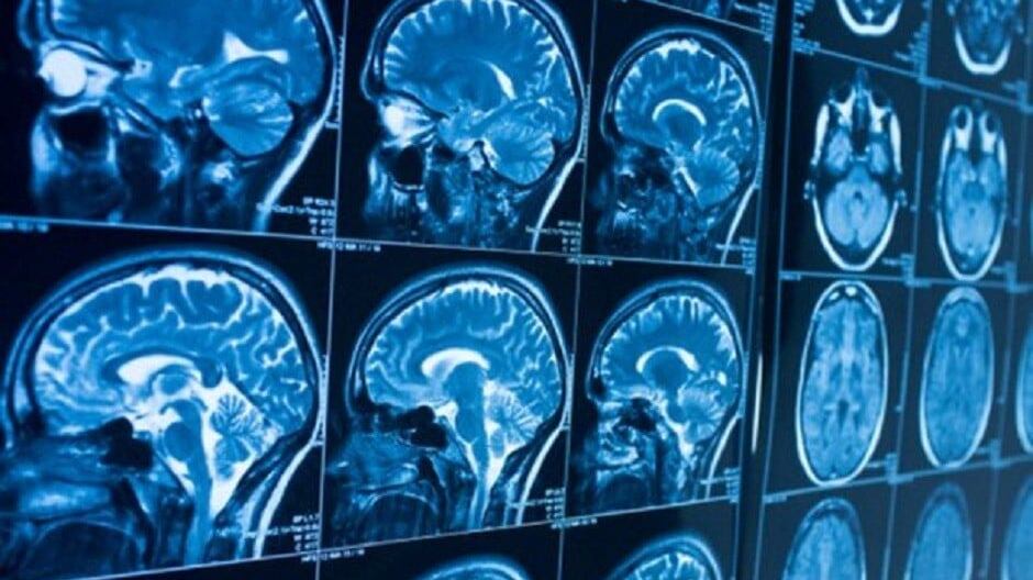 Imágenes de cerebro