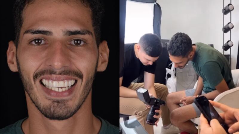 Agenor Tupinambá, da capivara Filó, vai mudar o sorriso e internautas reagem: “Eu não mexeria”