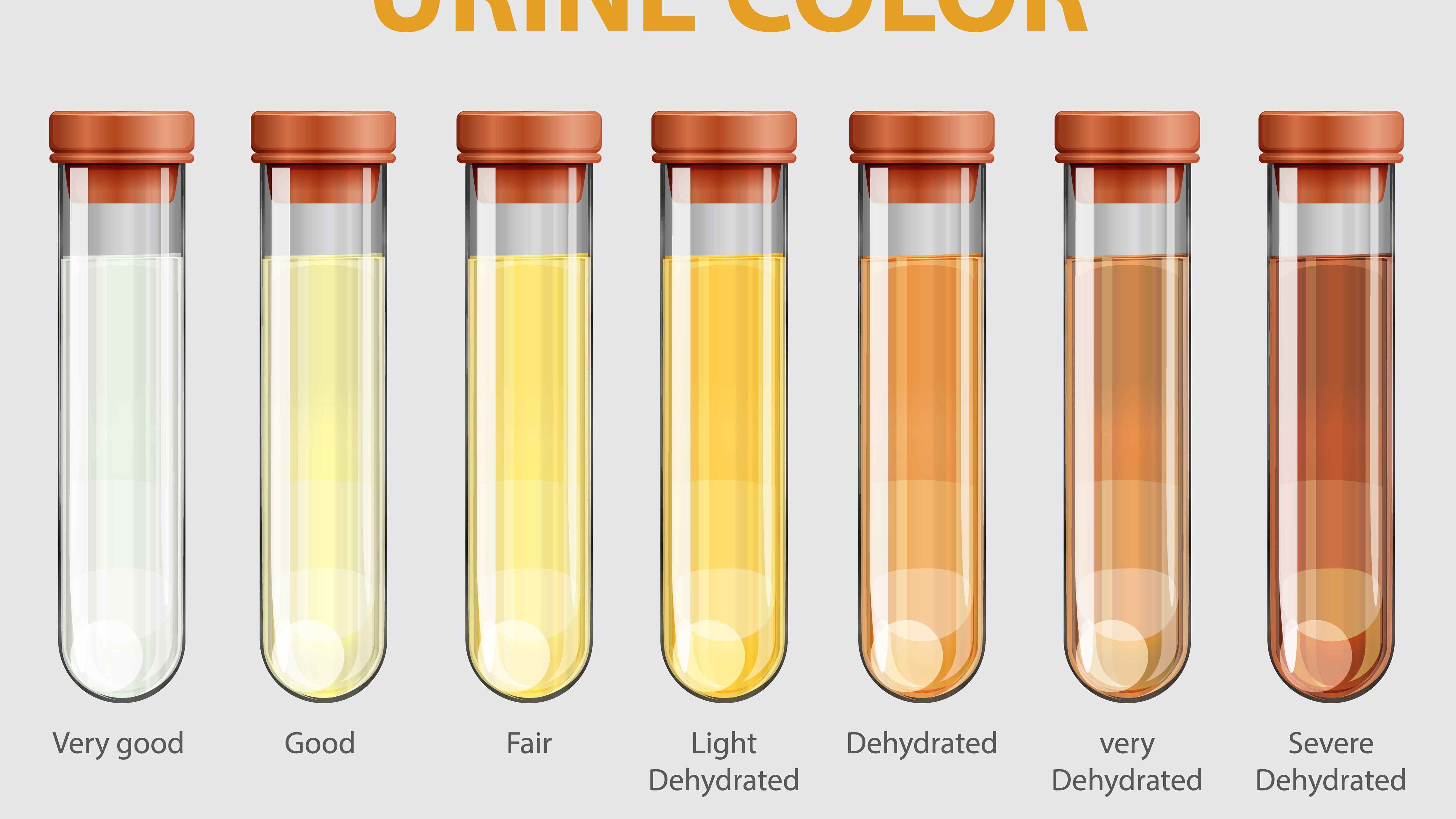 Cor da urina pode indicar estado de saúde