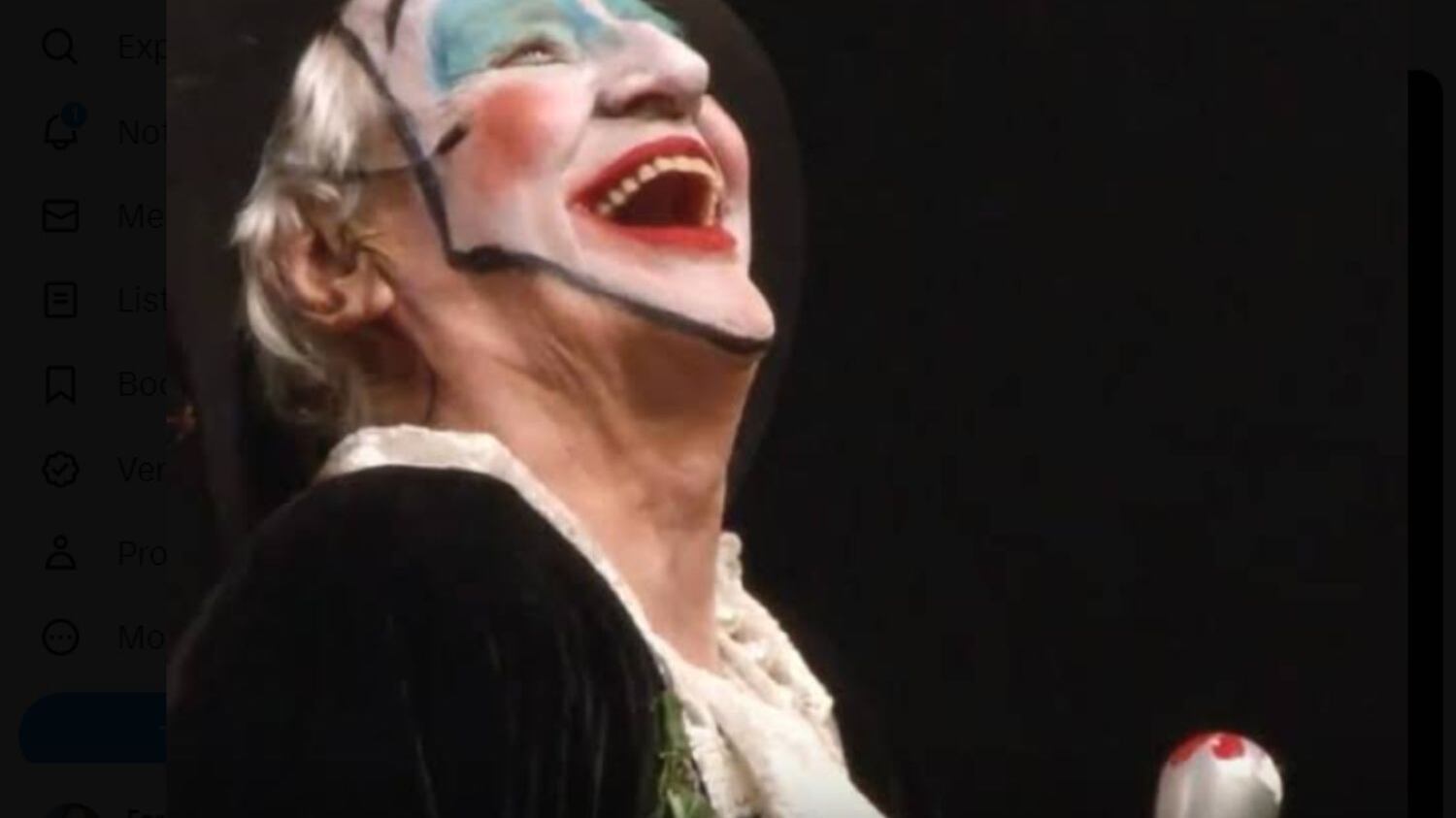 Ele teve 53% do corpo queimado em um incêndio no seu apartamento, em SP