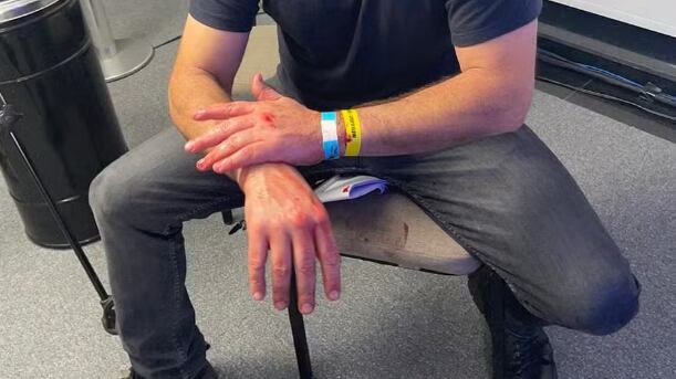 Duda Lima registrou b.o contra fotógrafo de Marçal, que o agrediu com um soco