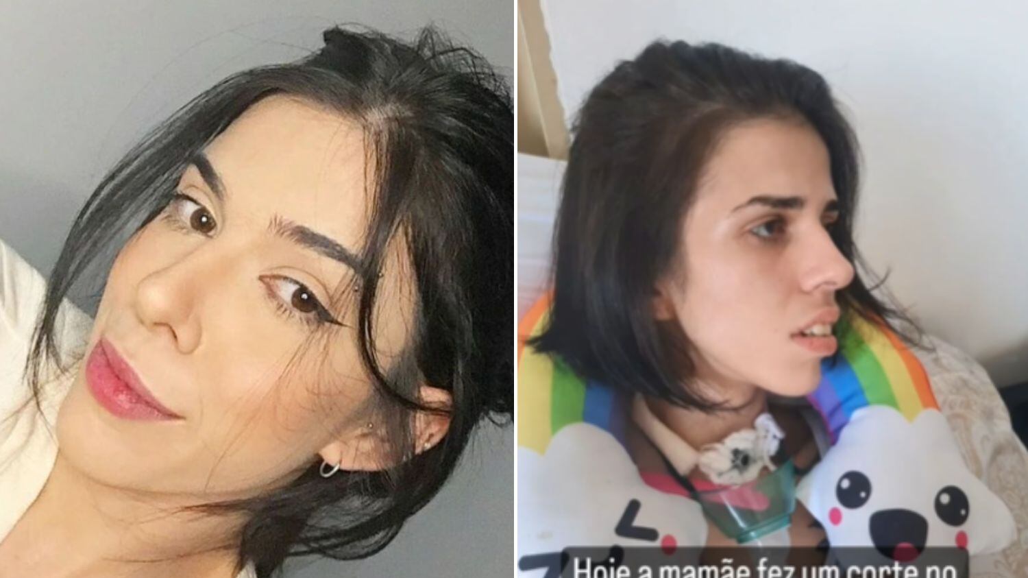 Jovem teve crise grave de asma ao cheirar pimenta