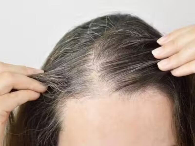 Combate ao cabelo branco/ reprodução