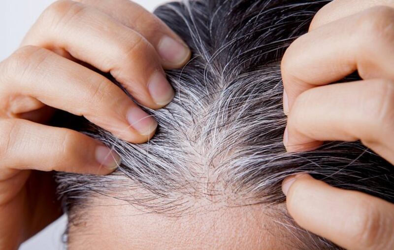 Bicarbonato para cabelos brancos/ reprodução