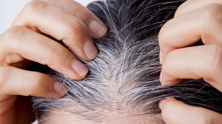 Bicarbonato para cabelos brancos/ reprodução