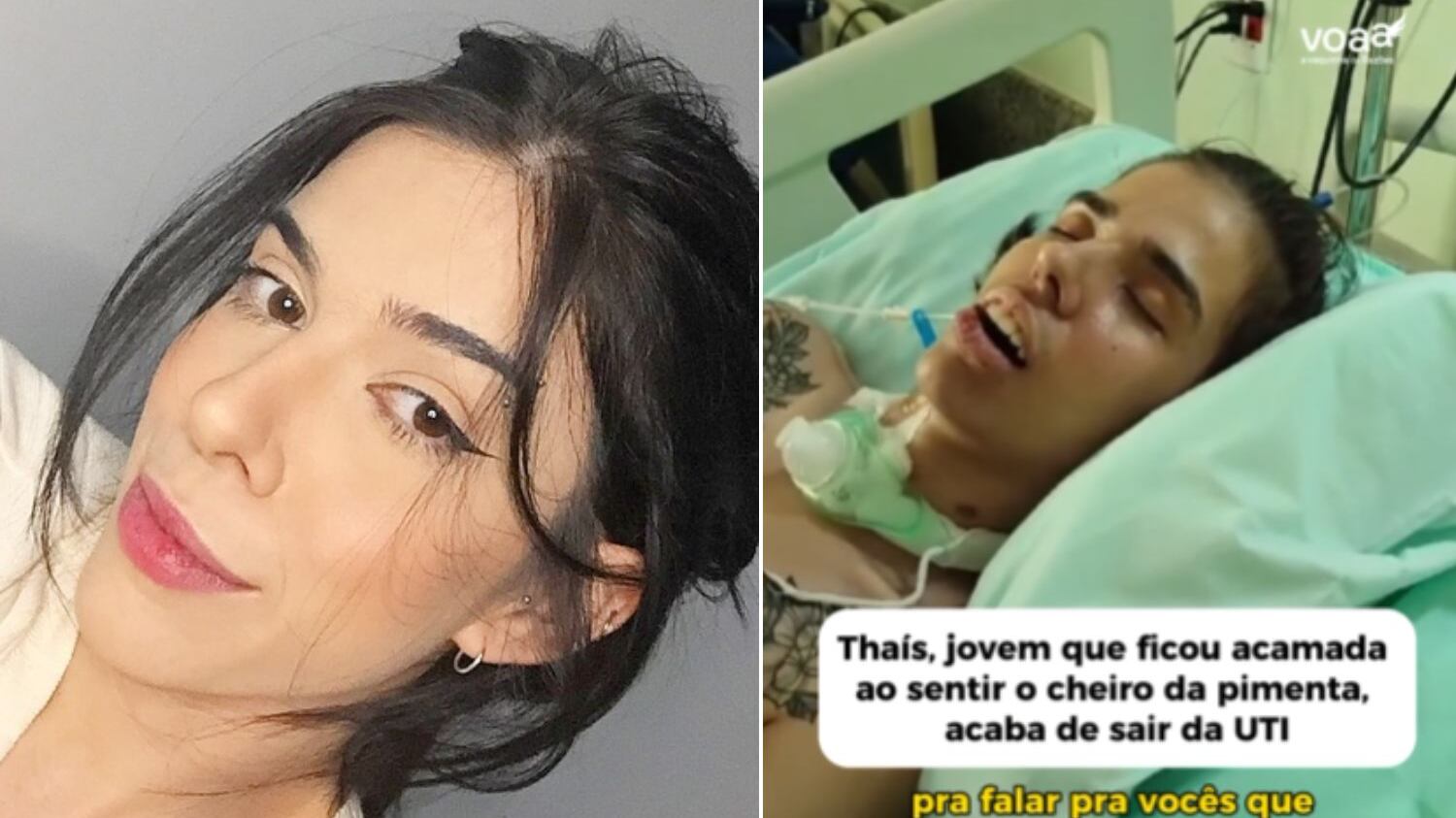 Jovem ficou acamada após reação à pimenta