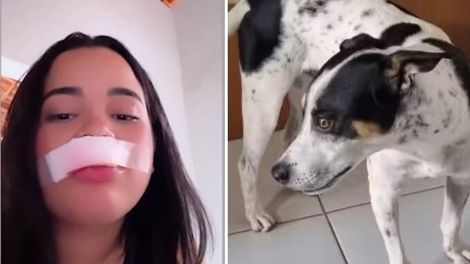 Modelo tem parte do lábio arrancado após tentar beijar o próprio cachorro: “Meu amor continua o mesmo”