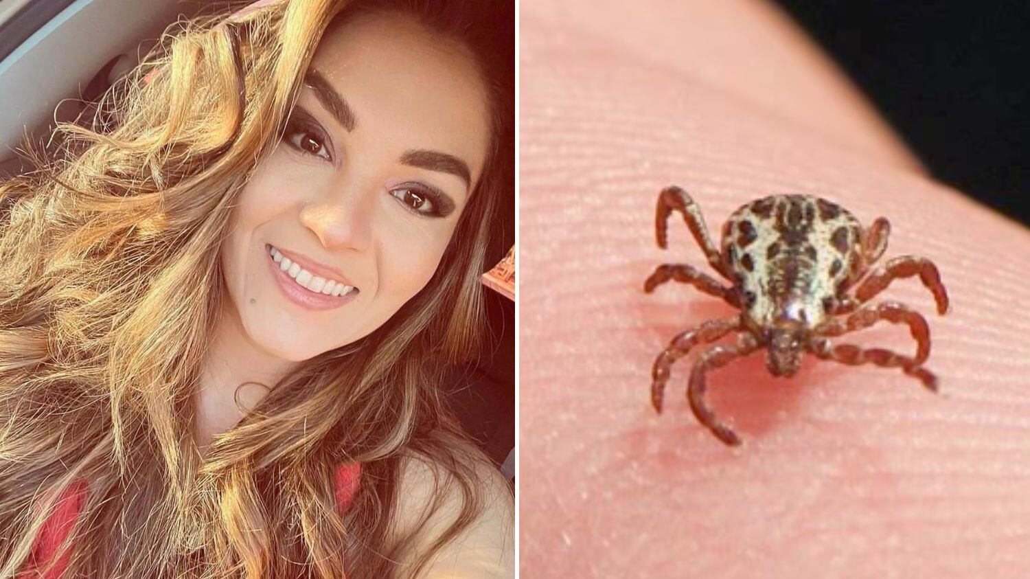 Noivo diz que caso dela foi tratado como dengue até se agravar