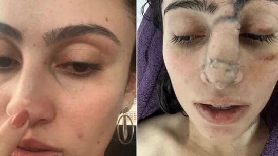 Juliana Lima Vilela, de 30 anos, teve câncer raro