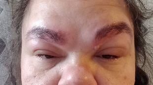 Mulher disse que ficou parecida com Scar, de Rei Leão.