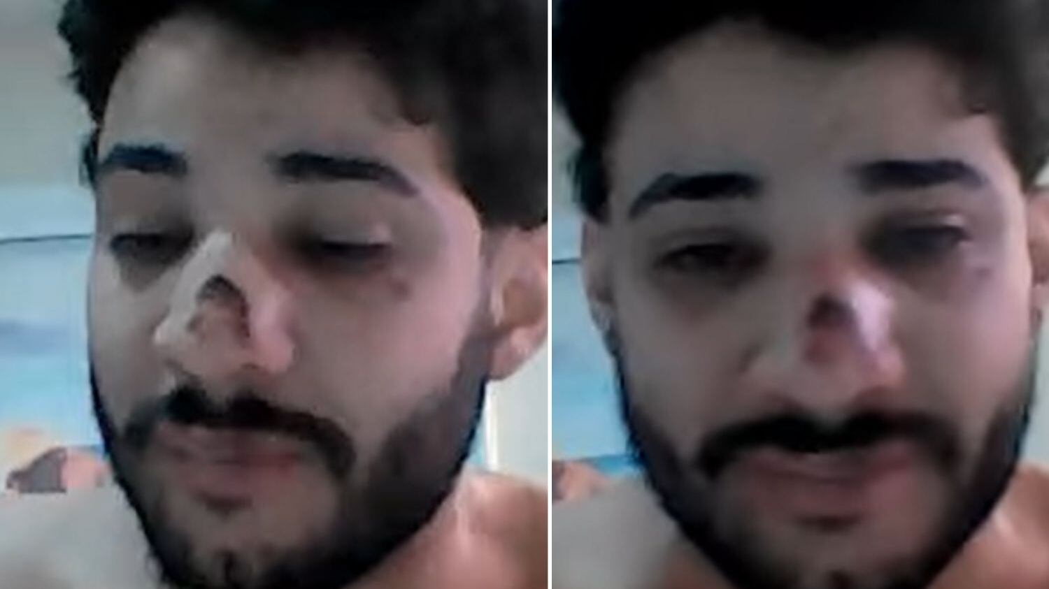 Ele foi agredido e roubado, no RJ