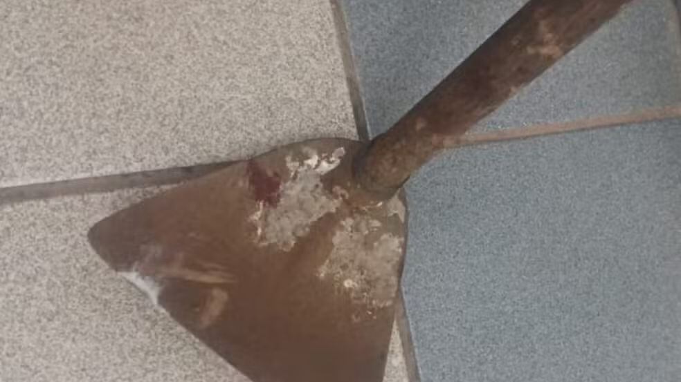 Mulher de 64 anos é agredida pelo filho com golpe de enxada na cabeça durante desentendimento familiar