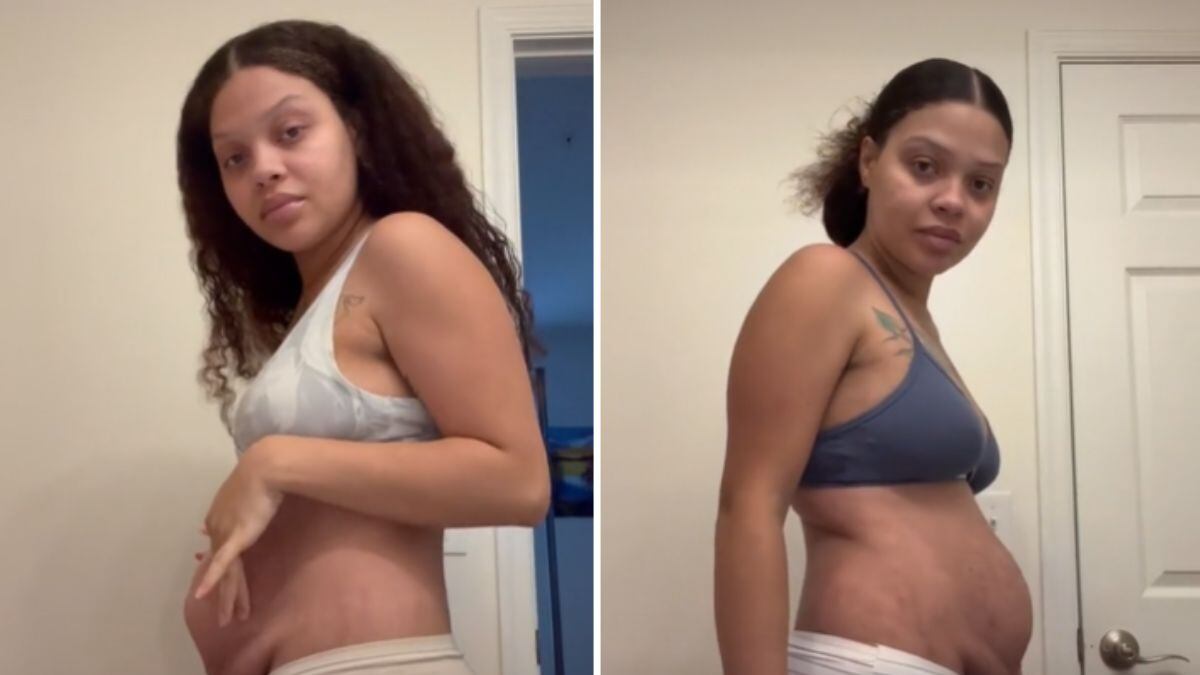 Mulher viraliza ao mostra corpo real após parto