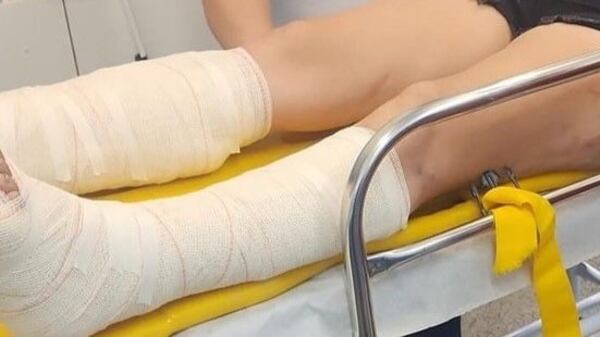 Mulher tem fraturas nas pernas ao ser agredida pelo ex-companheiro