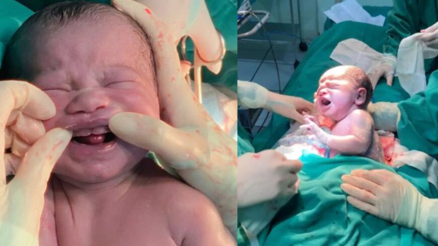 Essa é a verdade por trás do bebê que nasceu com seis dentes no Mato Grosso do Sul