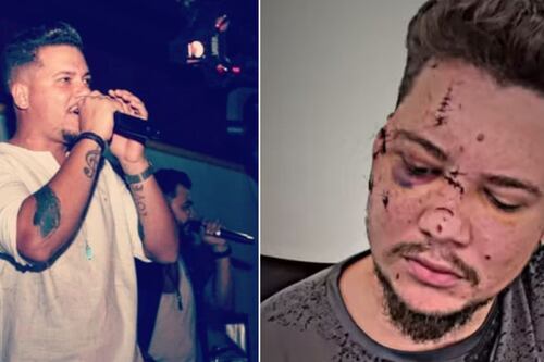 Sertanejo que levou 32 pontos após agressão lamenta perder fotos de família: “Rosto desfigurado”