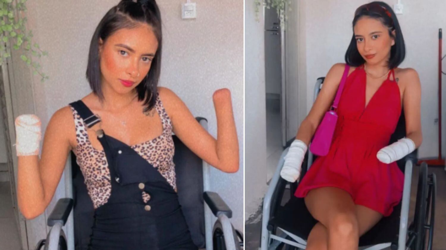 Jovem ainda tenta se adaptar à nova realidade