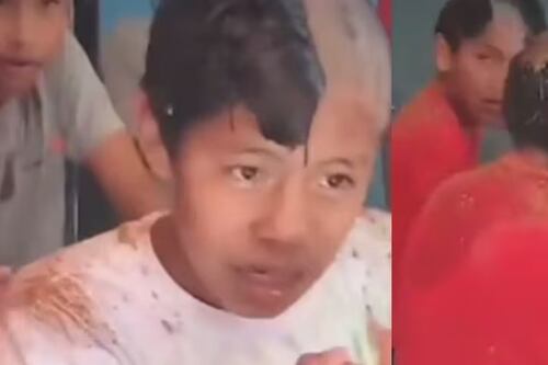 Jovens ficam sem cabelos ao usar creme depilatório em vez de shampoo