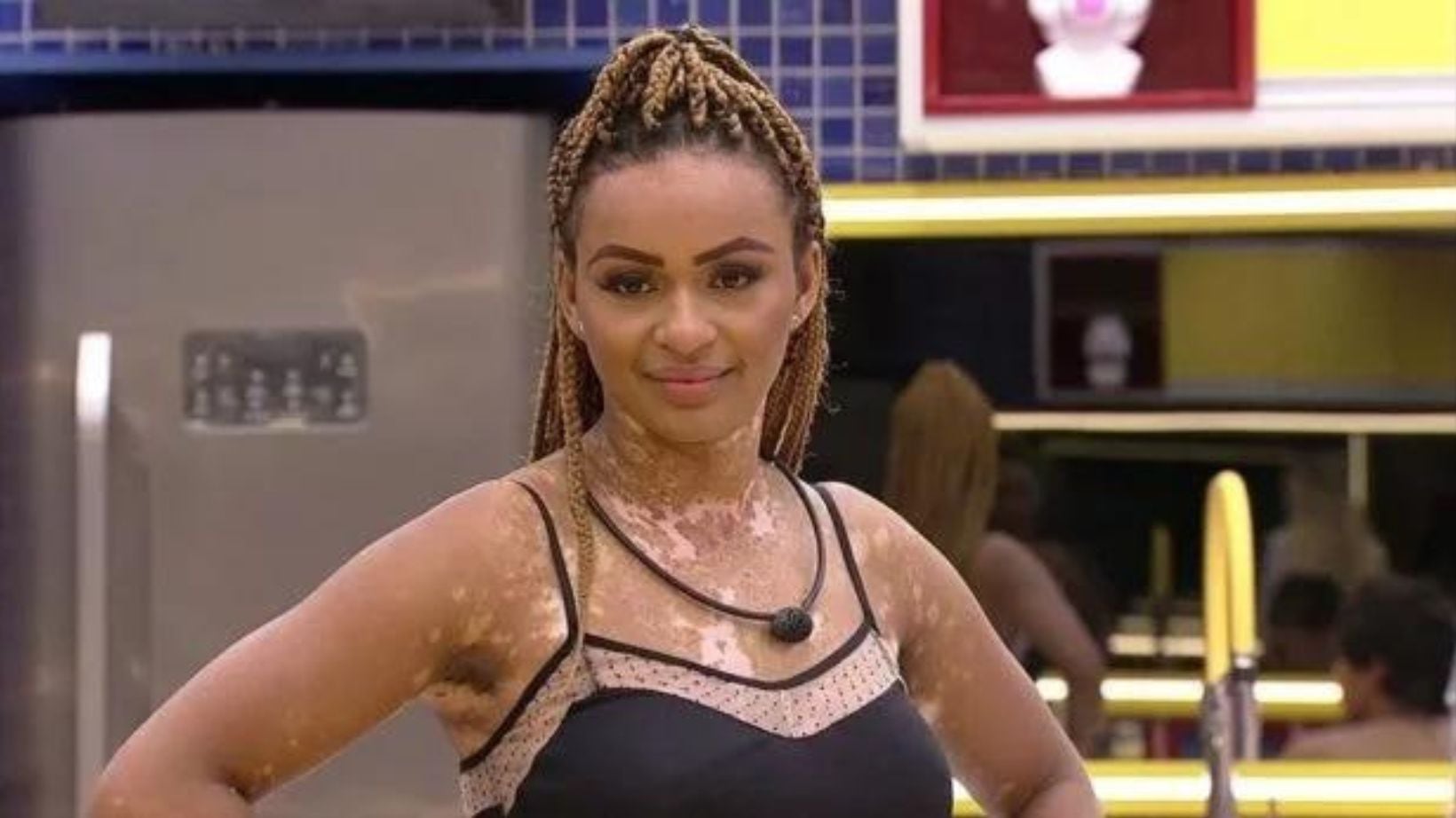 BBB: Natália Deodato fez uma cirurgia no fim de 2023, mas acalma seguidores