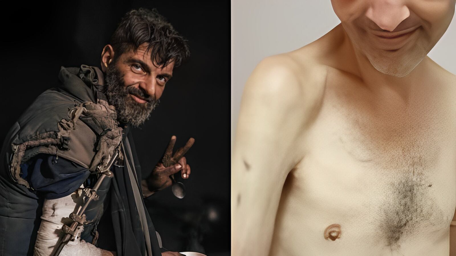 Reflexo da guerra: a impactante mudança física de soldado ucraniano libertado em troca de prisioneiros