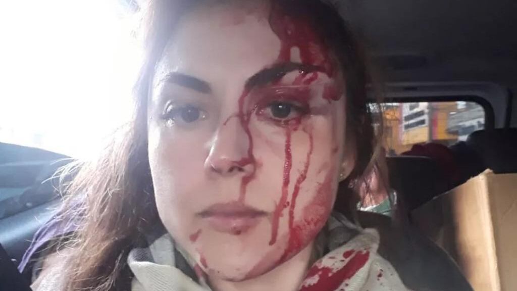 Gabriela Samadello Monteiro de Barros foi agredida por outro procurador