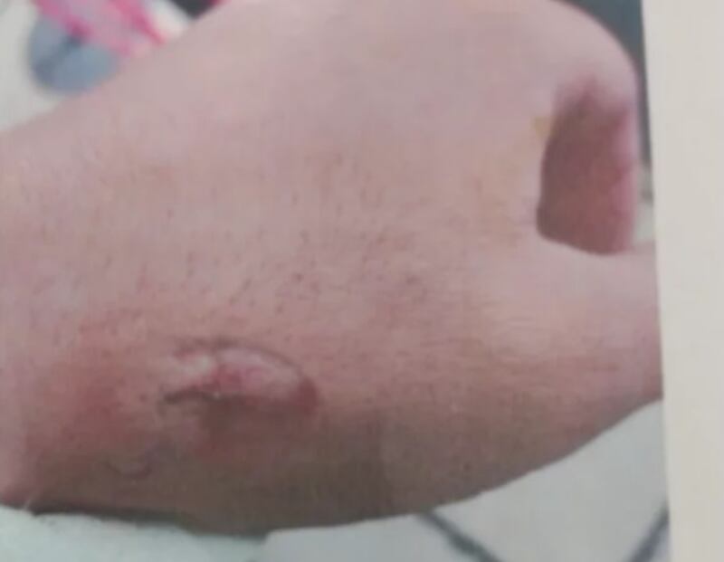 Mulher morde mão de policial após ser impedida de entrar em bar