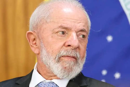 Lula passa por exames de rotina para controle após operação no crânio: “Dentro da normalidade”