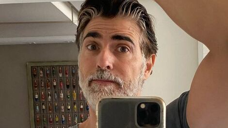 Reynaldo Gianecchini 'ganhou' hematoma durante gravações de série