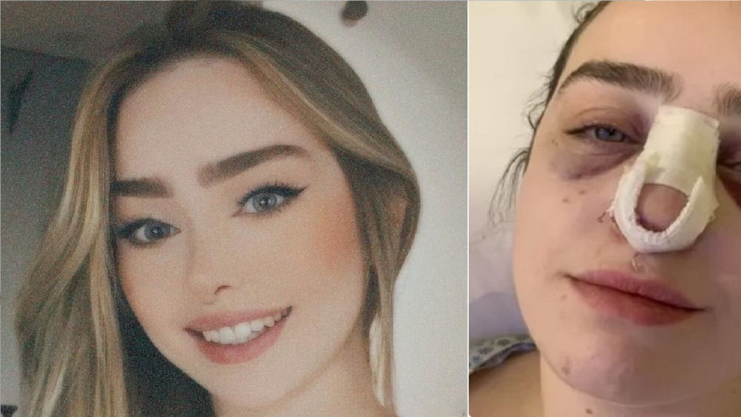 Mulher é agredida por homem desconhecido em rua de São Caetano