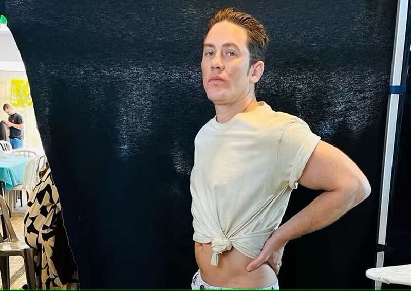 Personagem de Leonardo Miggiorin se submeteu a vários procedimentos estéticos em Beleza Fatal