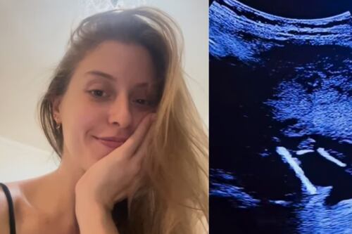 Grávida viraliza ao mostrar bebê chutando DIU durante ultrassom: ‘Será amado e bem-vindo’