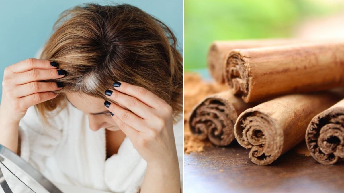 La canela tiene muchas propiedades que ayudan a la salud capilar