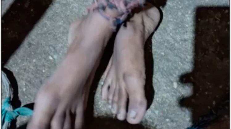 Filhos eram mantidos amarrados em casa e estavam desnutridos