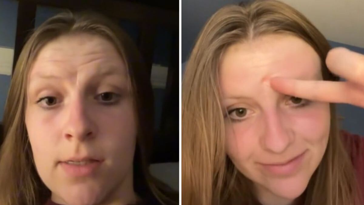 Mulher viraliza ao dizer que 'comeu' irmã gêmea no útero