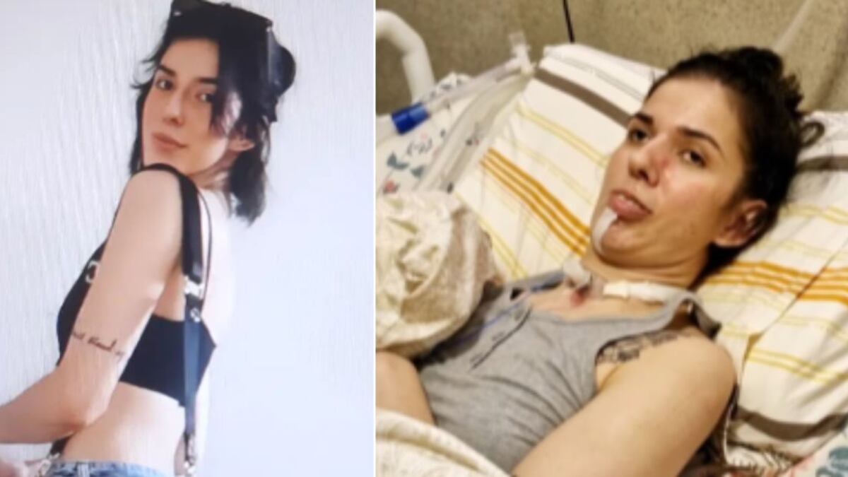 Jovem teve crise grave de asma após cheirar pimenta e sofreu lesões neurológicas