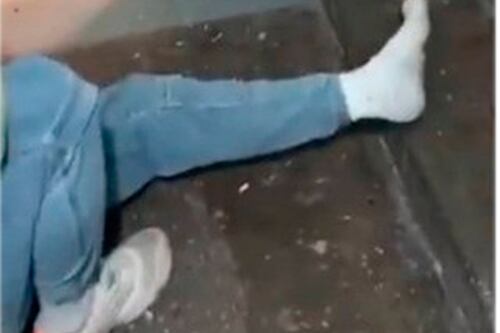 Vídeo de russo quebrando a perna para não lutar na Ucrânia viraliza