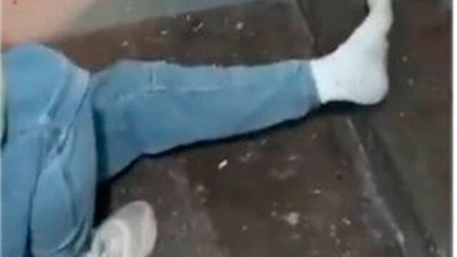 Jovem russo tenta quebrar a perna para fugir da convocação