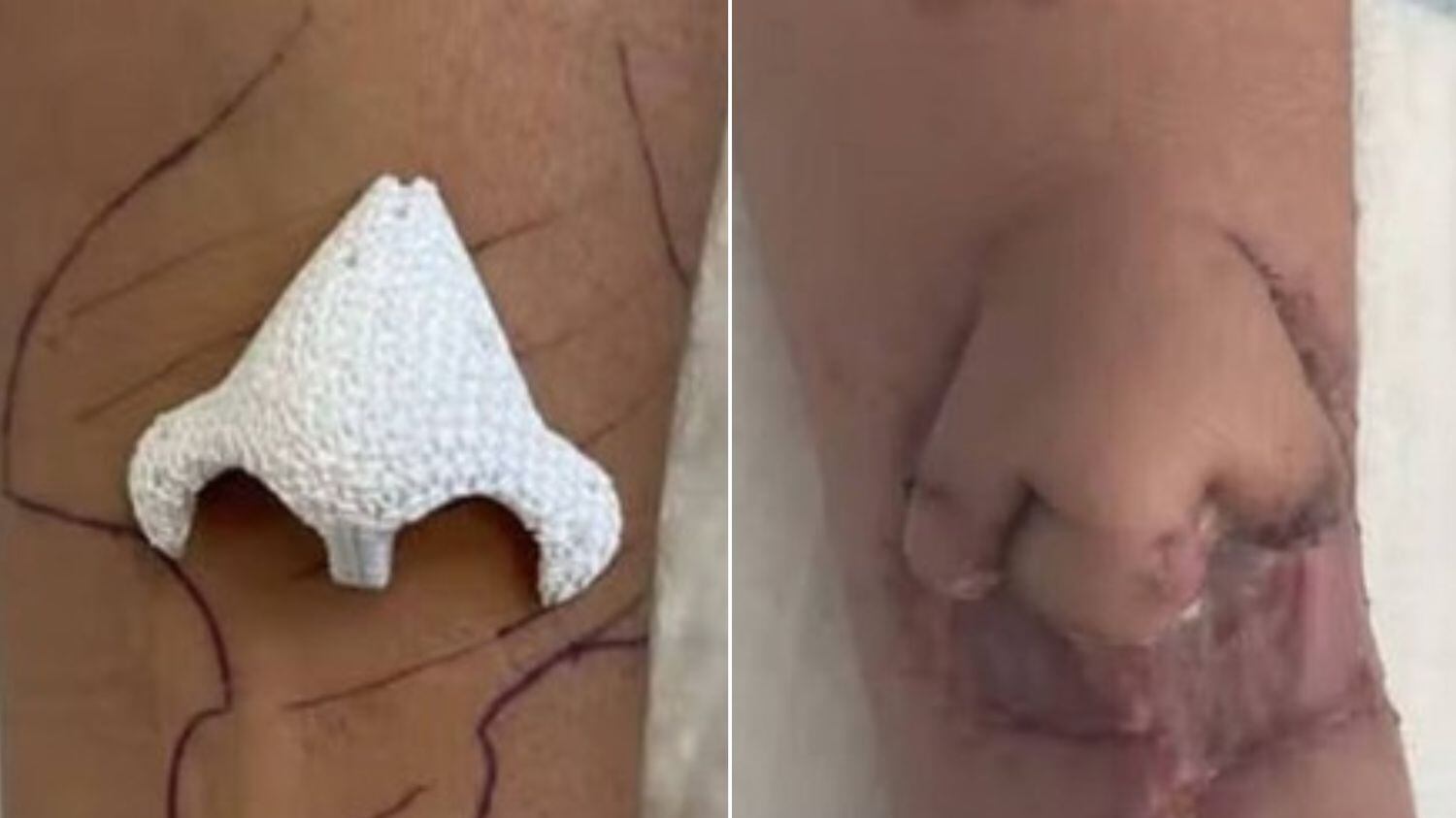 Caso ocorreu em Toulousse, na França