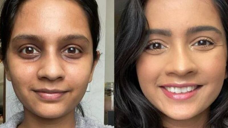 Maquiagem: Esses são os truques para cobrir manchas de acne como uma profissional