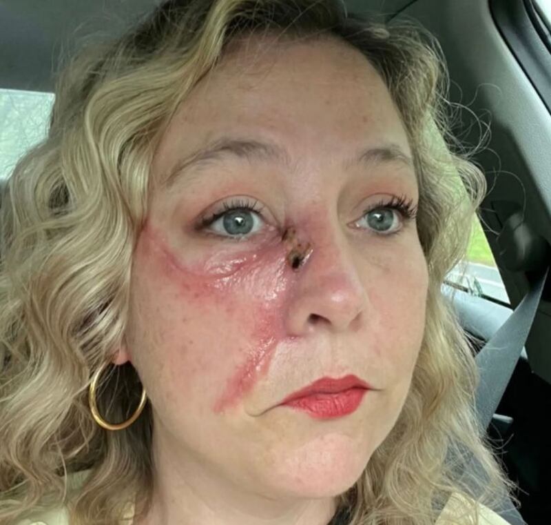 Mulher descobriu câncer raro após foto