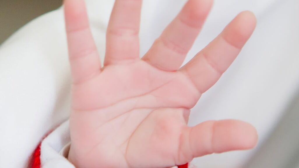 Foto da mão de Nala, filha de Iza e Yuri Lima, gera polêmica e comentários preconceituosos na web