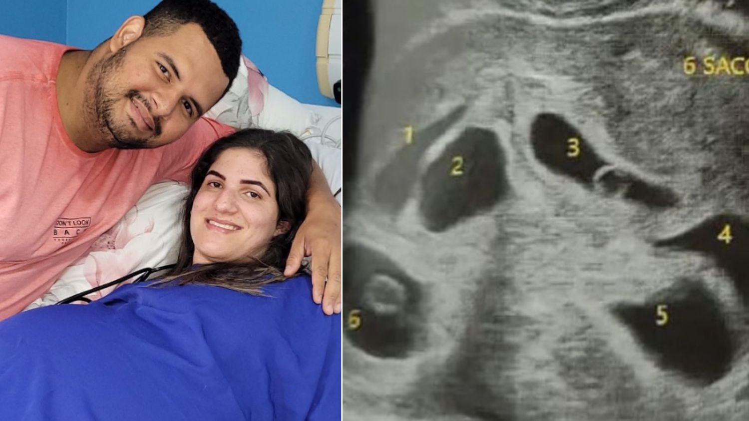 Todos os bebês estão em UTI e passam bem