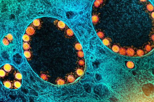 Primeiro caso da Ômicron XBB.1.5 no Brasil é identificado em São Paulo