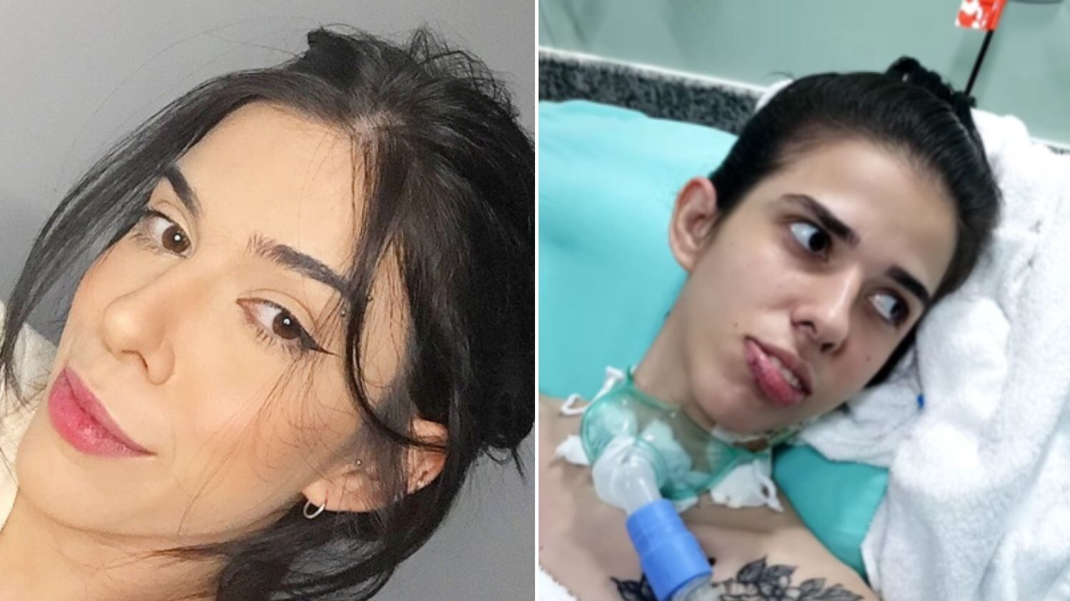 Ela segue acamada após sofrer reação à pimenta