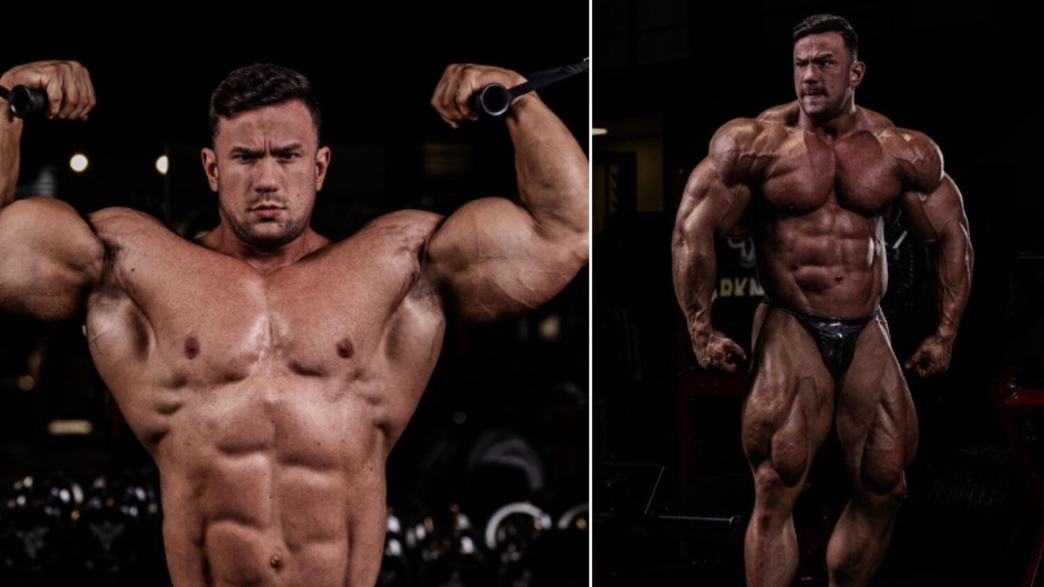 Ele teria sofrido complicações após cirurgia