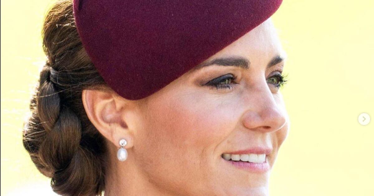 Why did Kate Middleton bandage her fingers during her last engagement?